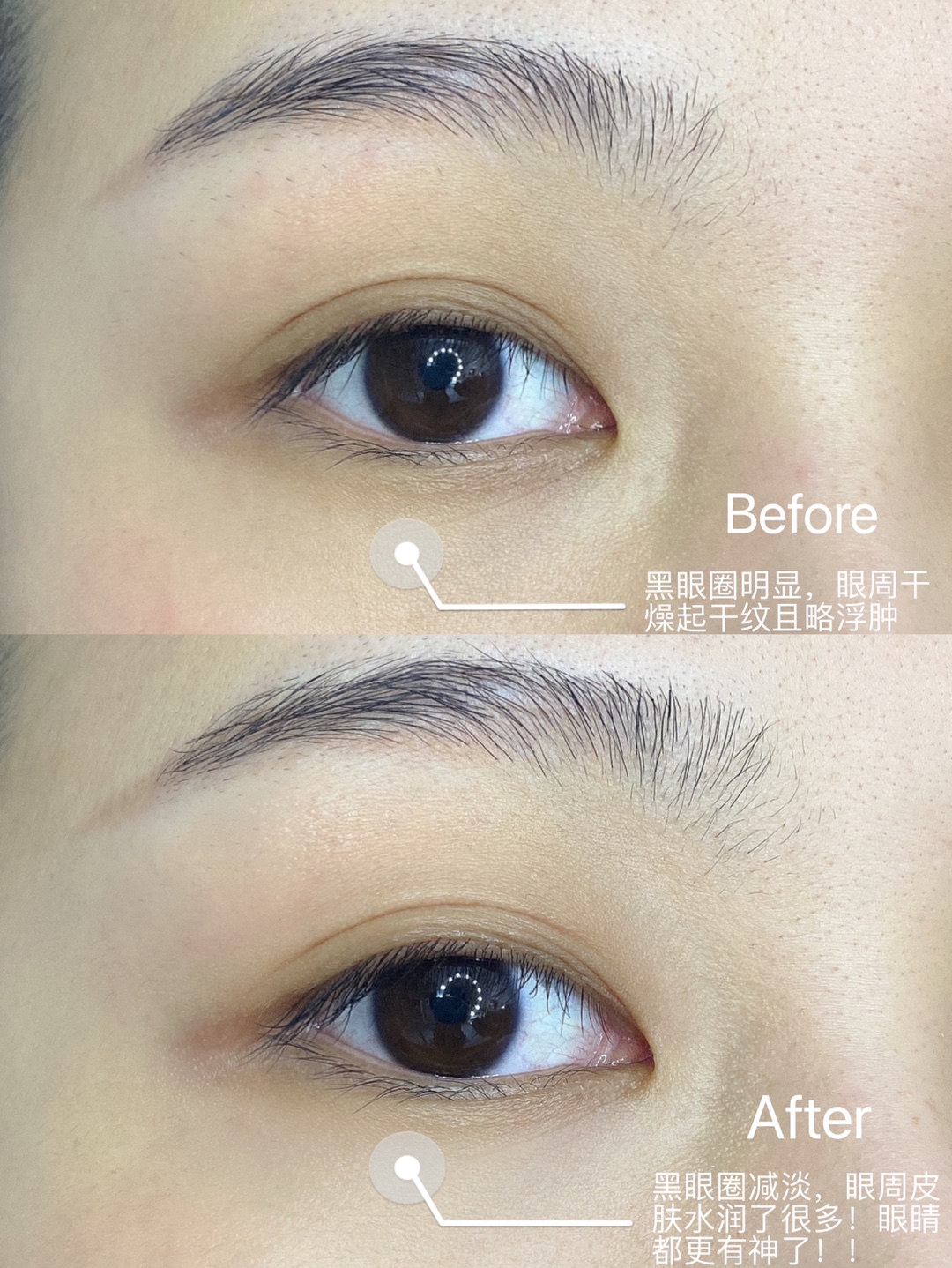 眼霜—Kerrykerry宝贝收到了，，，，刚用肌肤嘟噜嘟噜的喝水，，，用完之后脸明显变白了，，，，很喜欢